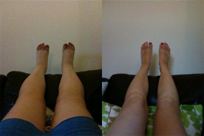 Brenda C. — before and after