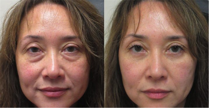 Linda M. — before and after