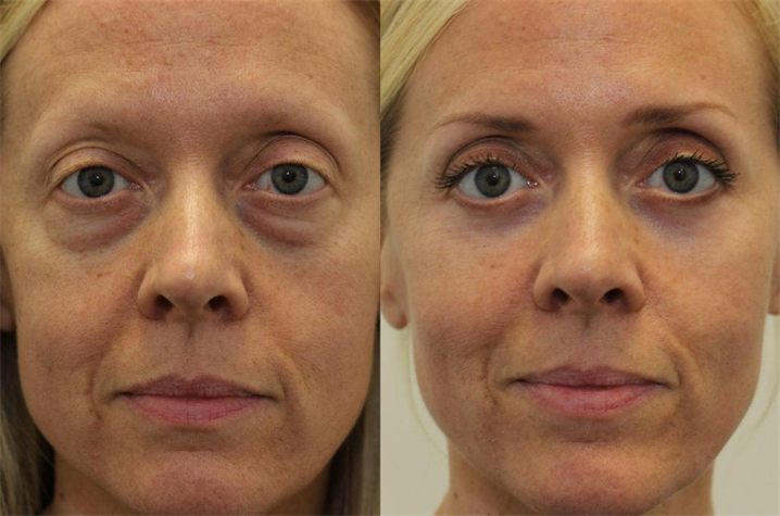 Rebecca T. — before and after